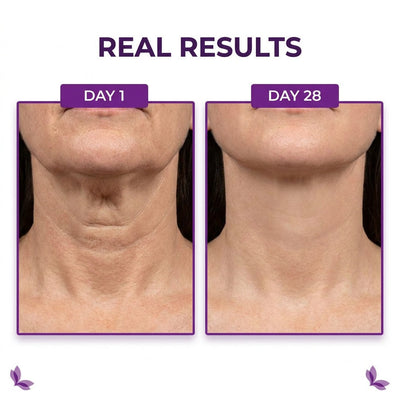 Real Results Day 1 vs Day 28